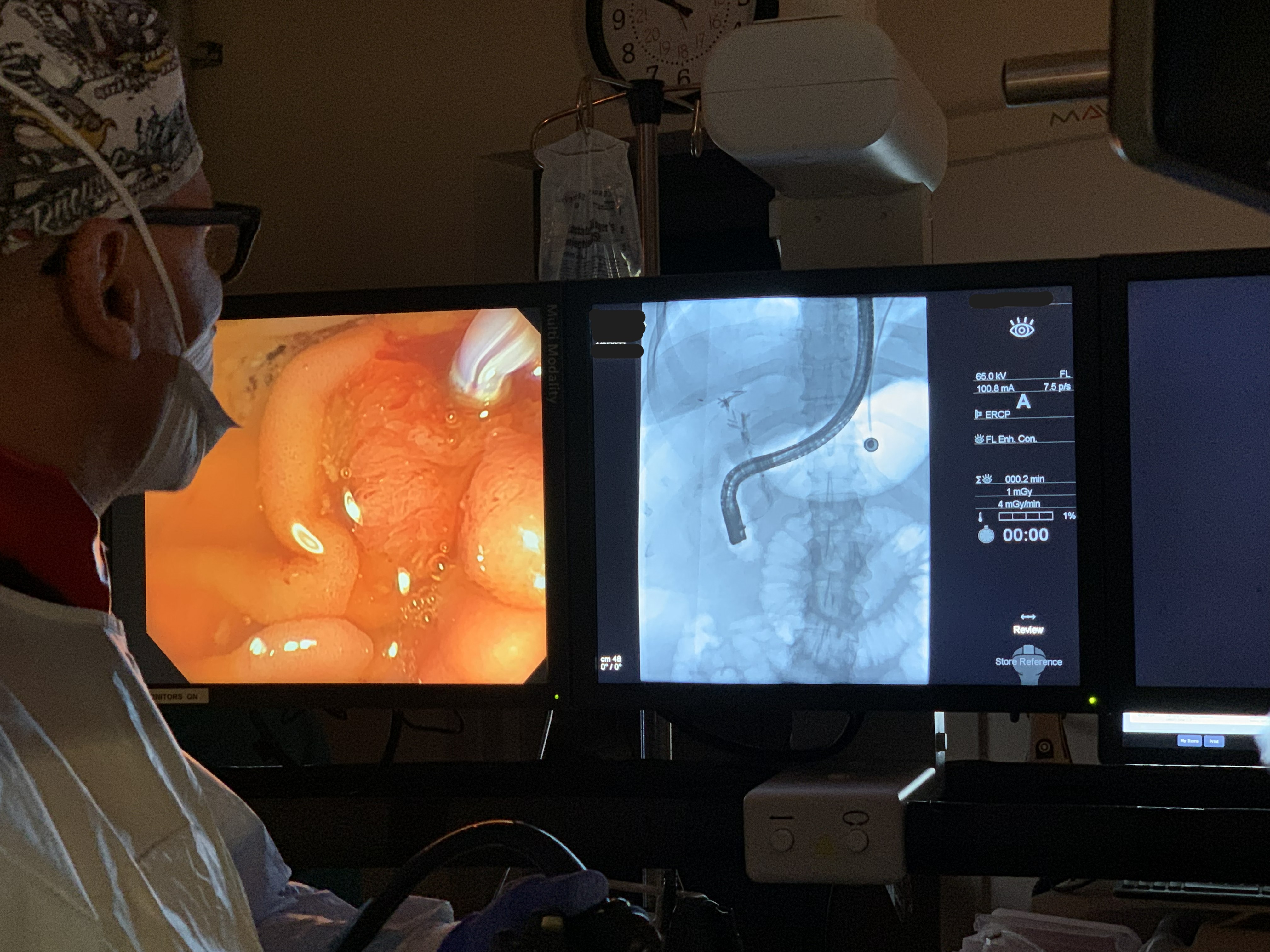 Dr. Todd Baron performing an ERCP procedure at UNC Advanced Endoscopy Fellowship